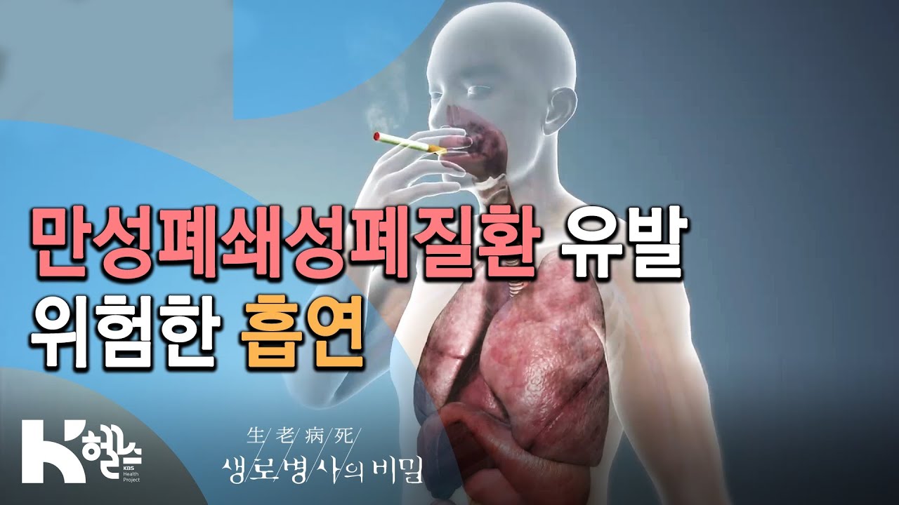 만성폐쇄성폐질환