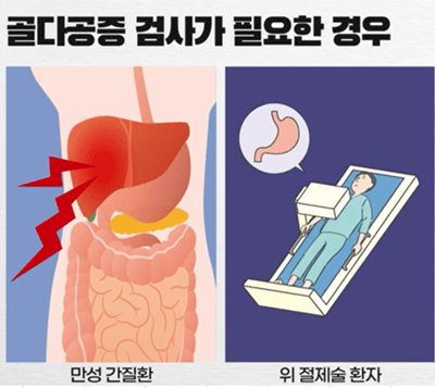 골다공증 검사 비용