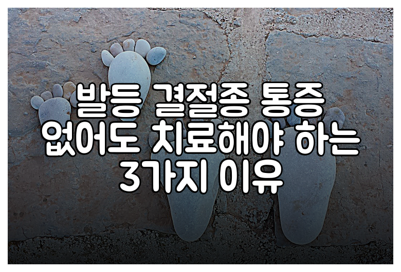 발등 결절종 통증 없어도 치료해야 하는 3가지 이유