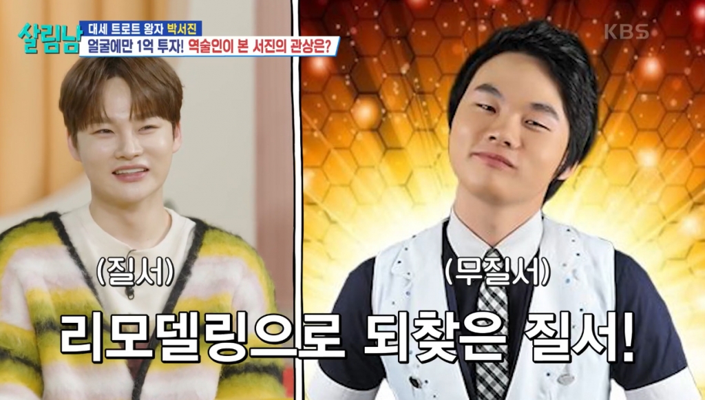 박서진 성형 분석