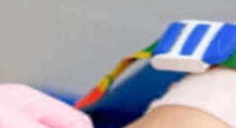 고지혈증증상혈액검사