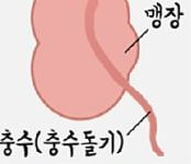 맹장염 증상