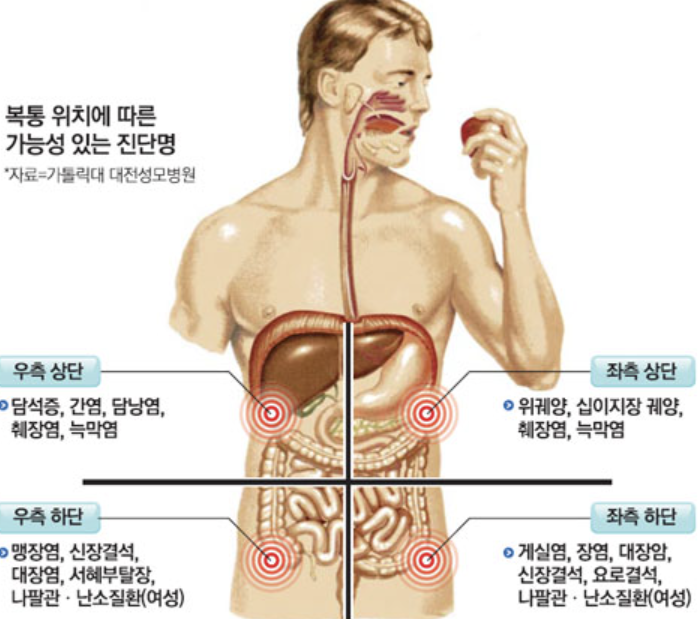 왼쪽 아랫배 통증 1
