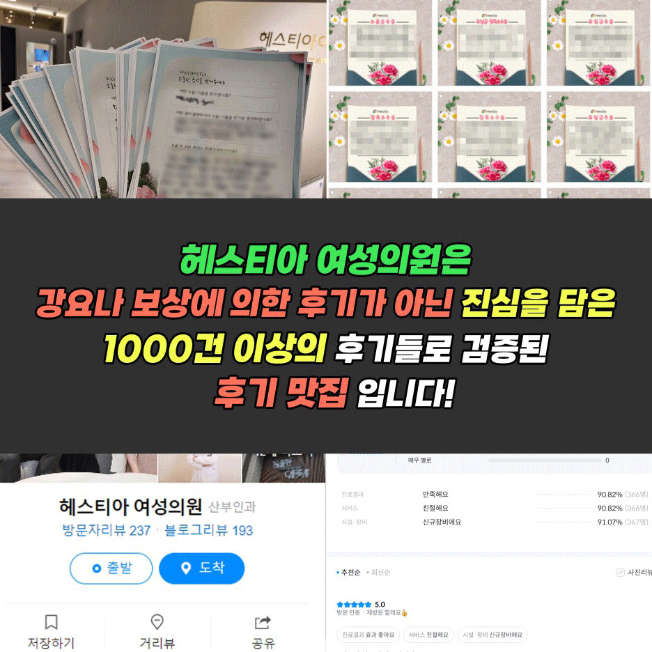 자궁내장치
피임루프
레보노르게스트렐