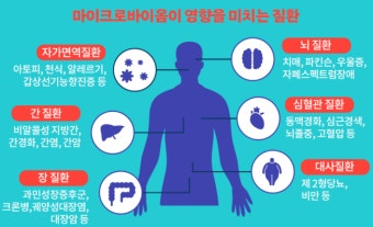 장건강 지키는 마이크로바이옴 7가지