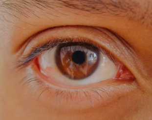 노안 수술 실비보험 가격 비용