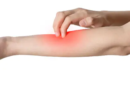 대상포진-무료접종-대상-가격-저렴한-병원-찾기-건강