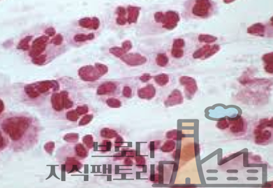 요도 간지러움