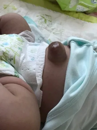 배보다 배꼽이 더 크다 뜻과 영어 속담 표현 안내집_8