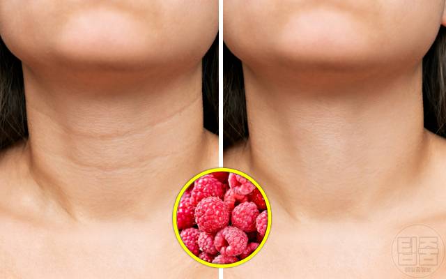 산딸기 어디에 좋은가요 산딸기 효능 목주름 콜라겐