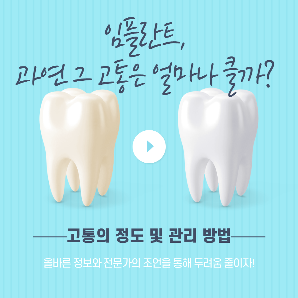 임플란트에 대한 올바른 정보와 전문가의 조언을 통해 두려움을 줄이고 건강한 치아 관리에 도움을 줍니다.