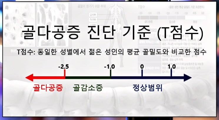 골다공증 정상수치