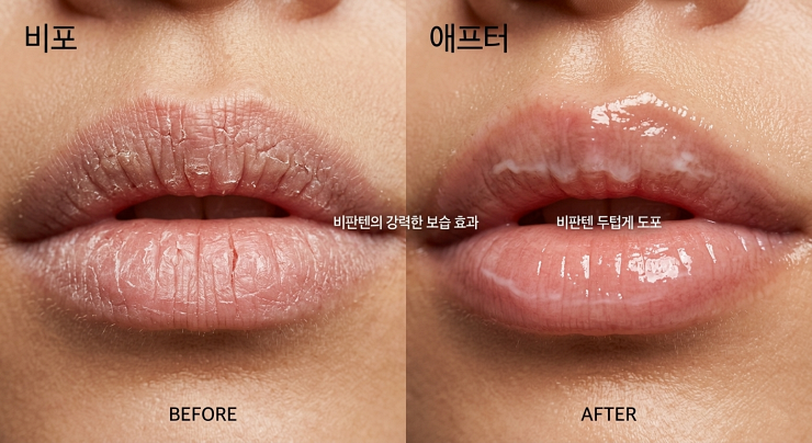 비판텐 입술 집중 케어