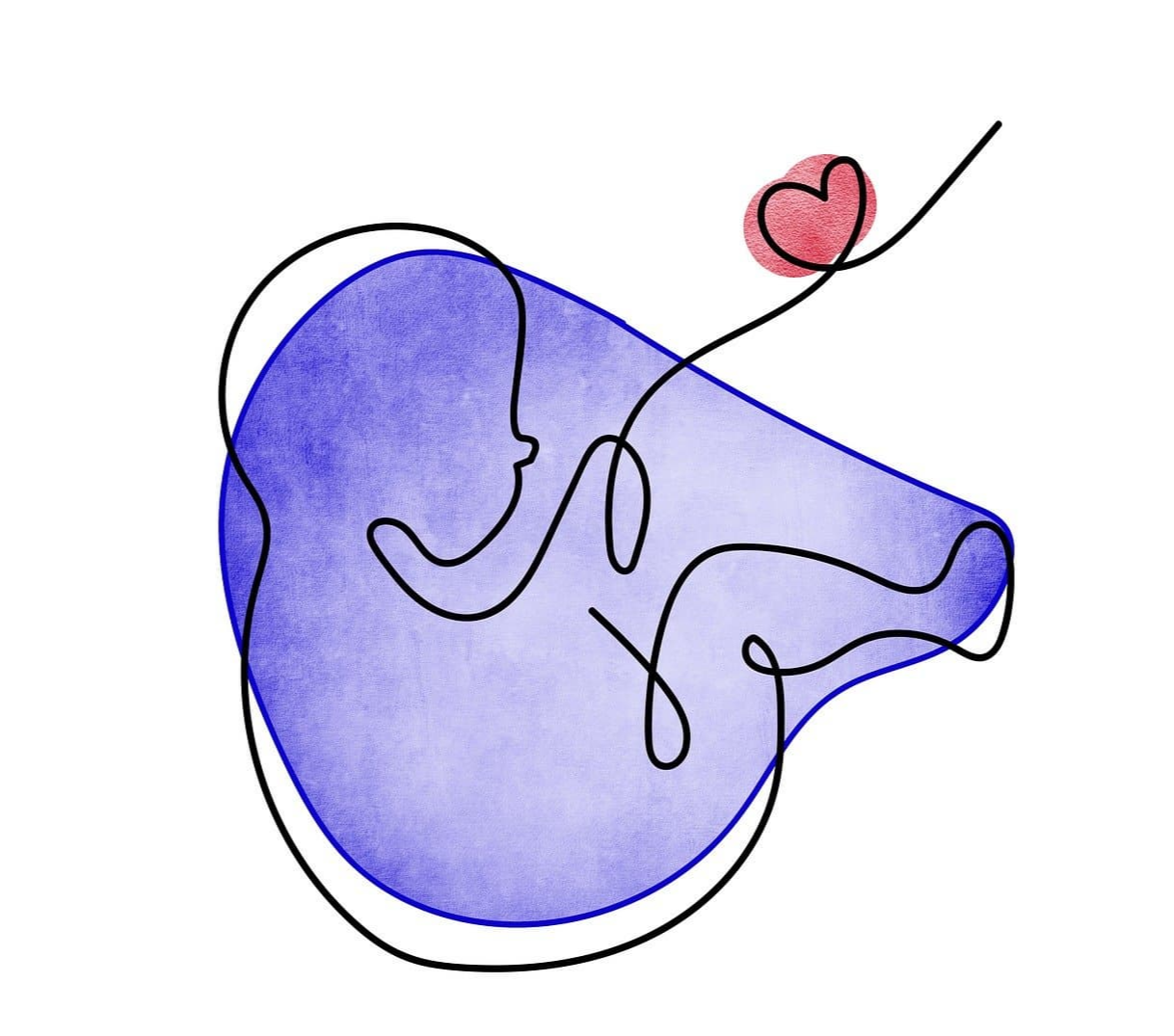 수술만 받으면 끝날까요?(구순구개열 치료)