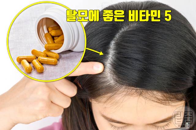탈모 비타민 음식 탈모에좋은비타민