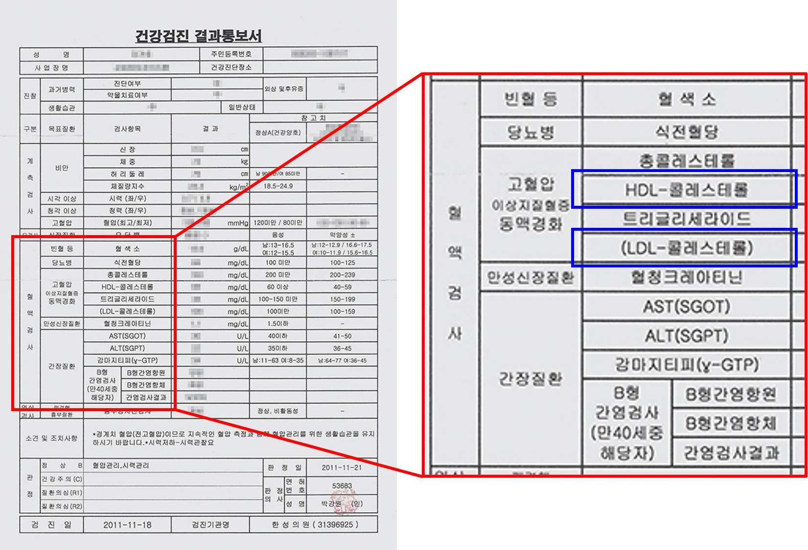 콜레스테롤