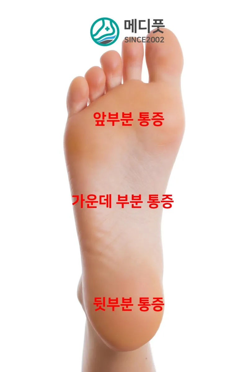 발바닥통증의 원인들과 해결책_8