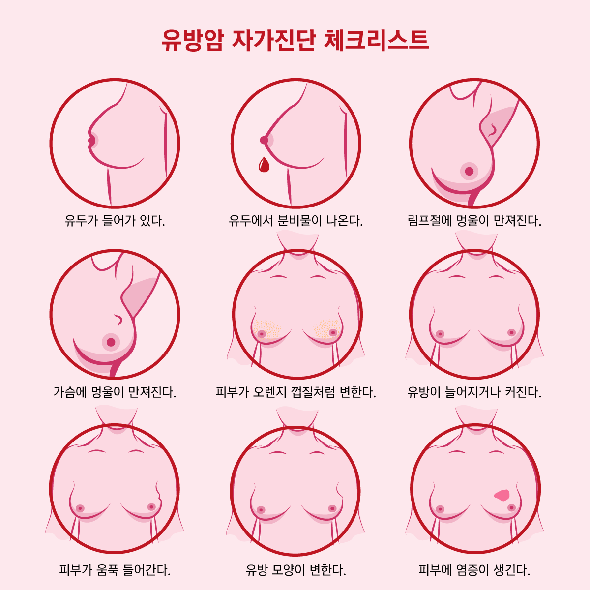 Breast cancer self-diagnosis checklist