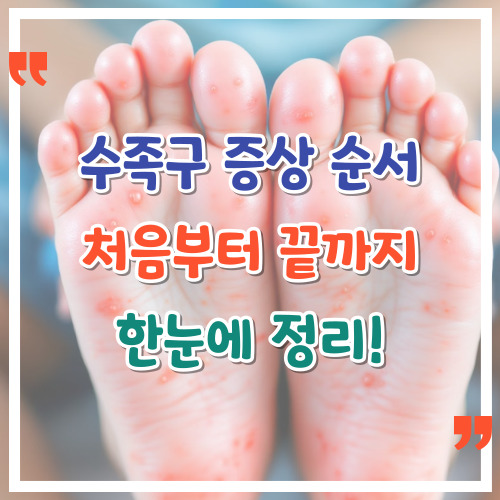 수족구-증상-순서-처음부터-끝까지-한눈에-정리