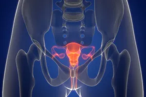 자궁근종-수술비용