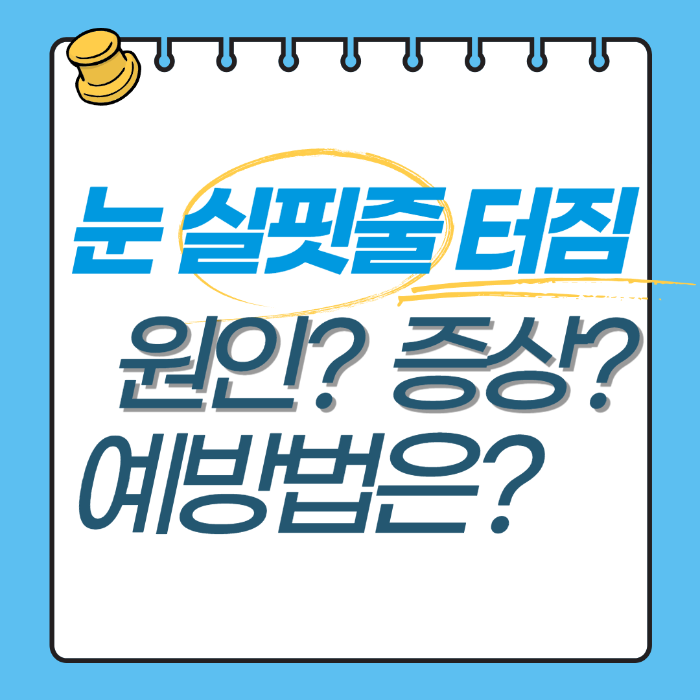 눈실핏줄터짐-방법은