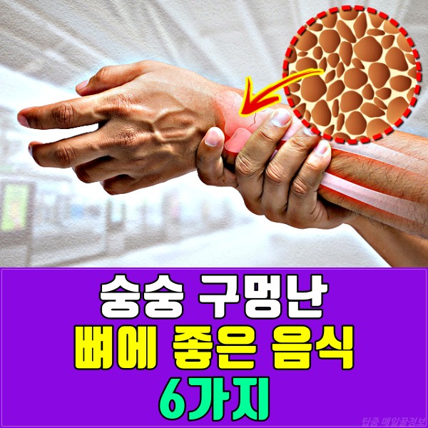 뼈 잘붙는 음식,뼈에 좋은 음식,골다공증에 좋은음식