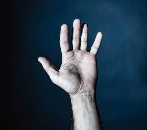 발가락 봉와직염