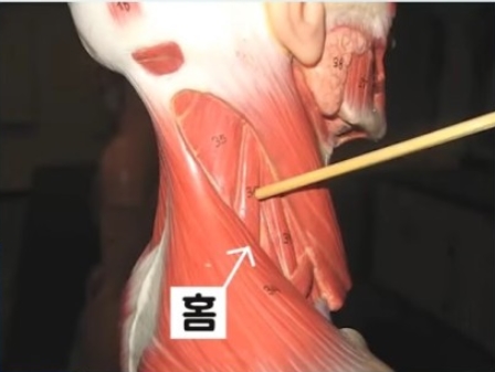 견갑거근마사지 도움 이미지