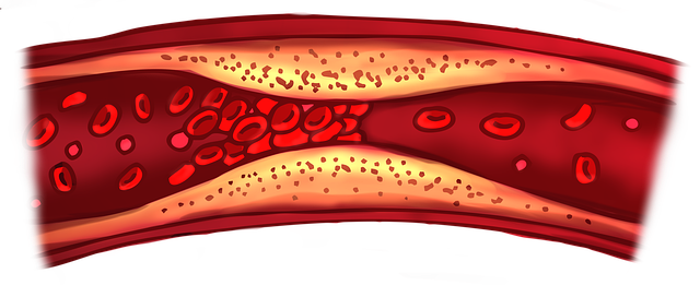 혈전을 녹이는 음식 5가지와 혈전 예방에 좋은 음식 5가지