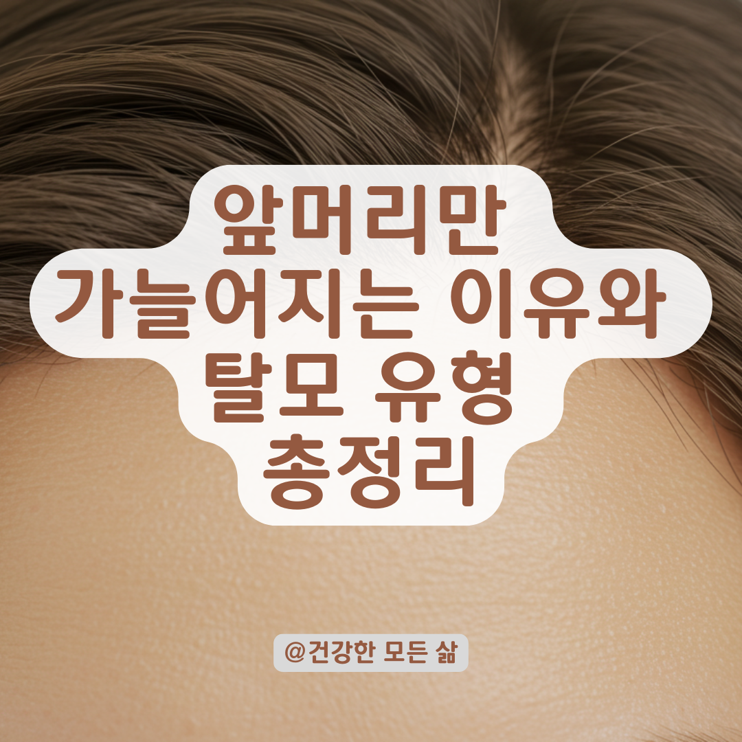 앞머리만 가늘어지고 자라지 않는다면? 여성 전두부 탈모 유형별 정리.