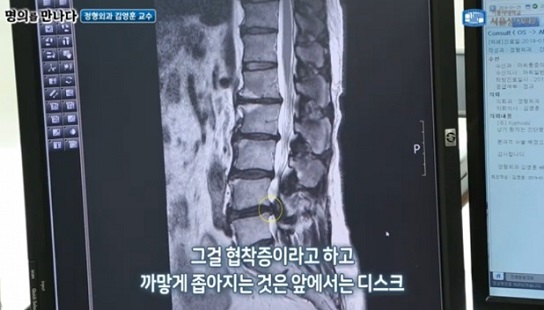 허리디스크