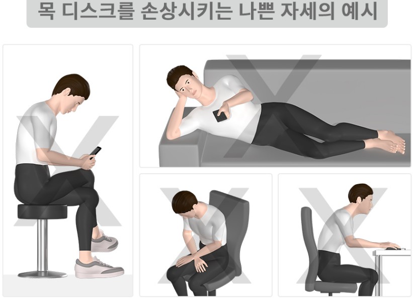 뻐근한 목 통증, 거북목 일자목 증상일까? 목디스크에 좋은 신전동작, 나쁜자세 운동