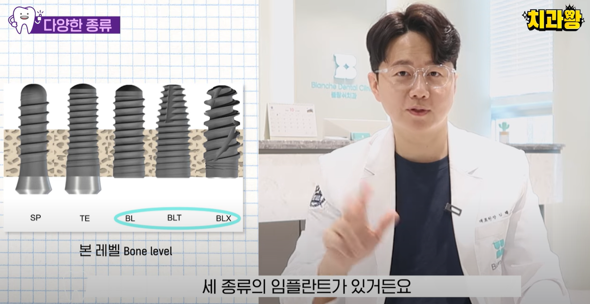 본 레벨의 종류는 BL, BLT, BLX가 있습니다.