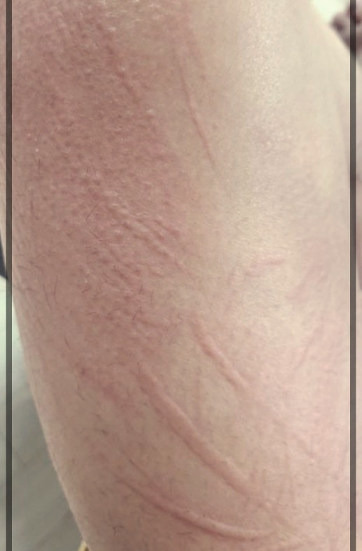 피부 기묘증 치료를 위한 실질적인 팁