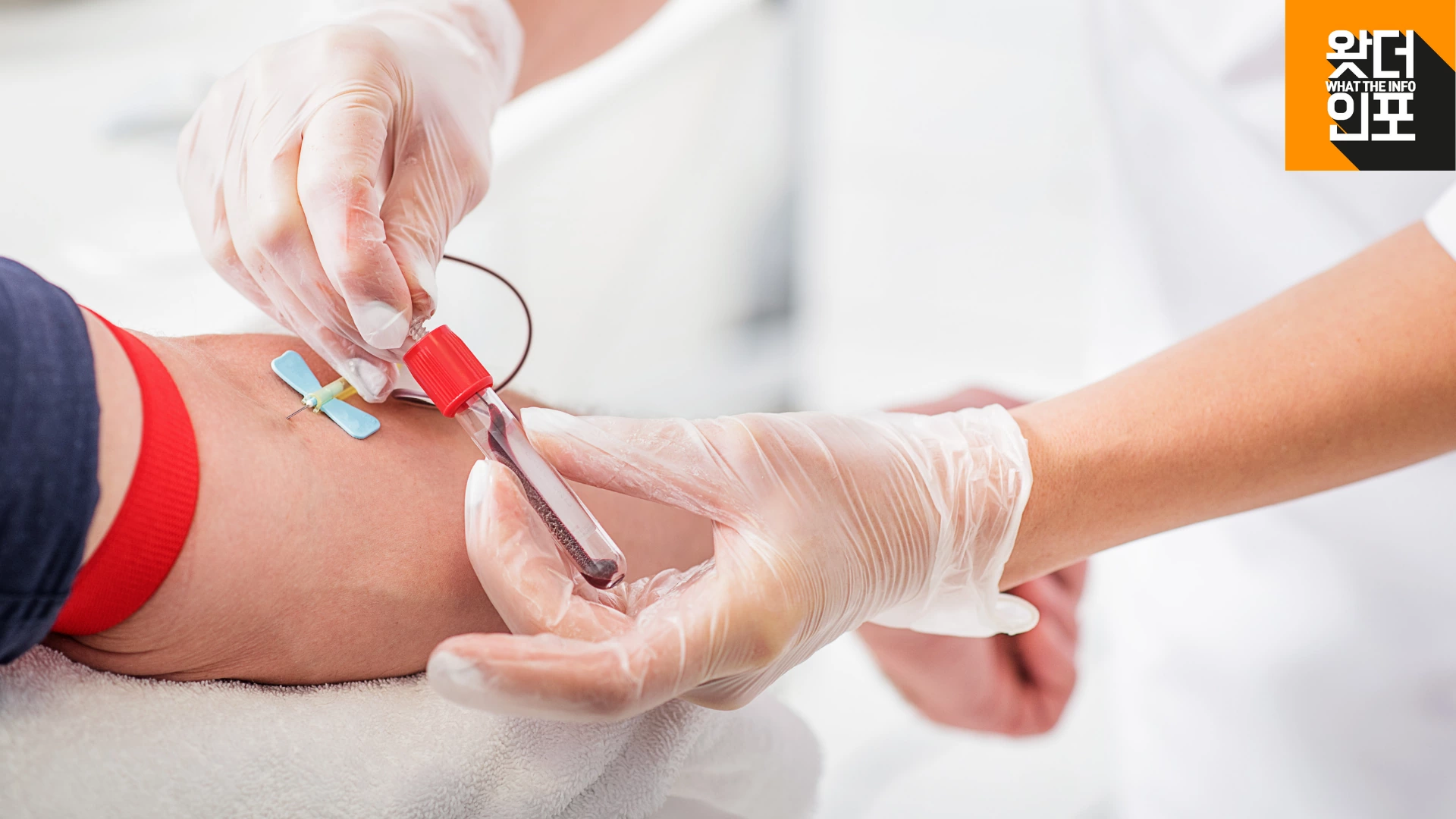 납 중독의 혈액검사 방법