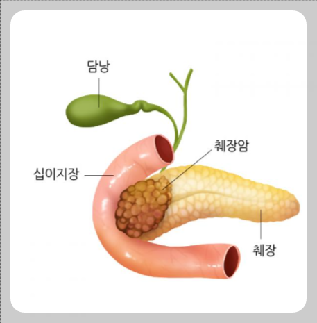 췌장에 좋은 음식
