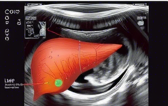 복부초음파 실비보험