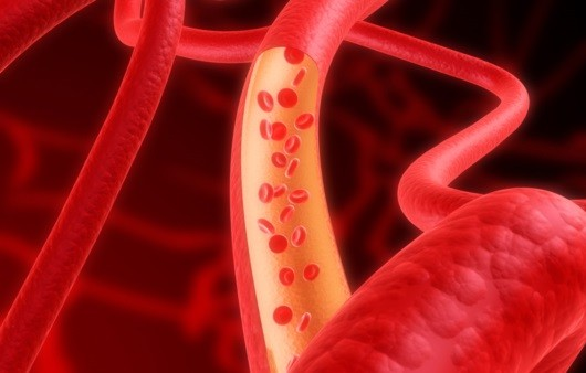 레보텐션정2.5MG : 심장과 혈관 작용