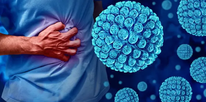 헤르페스 2형 바이러스