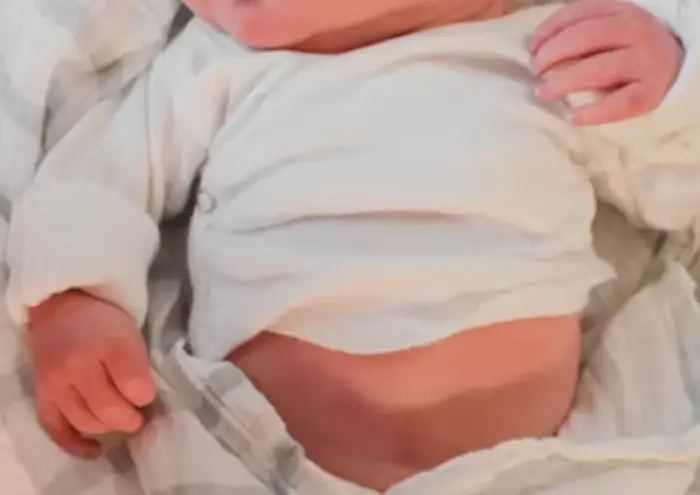 수족구 초기증상