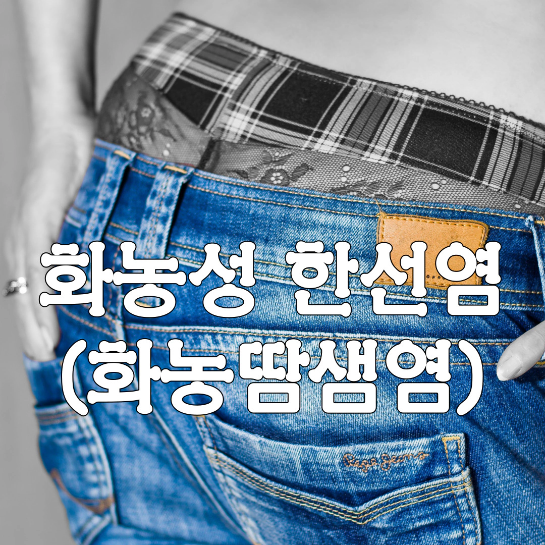 화농성 한선염 "여드름 보다 심각"