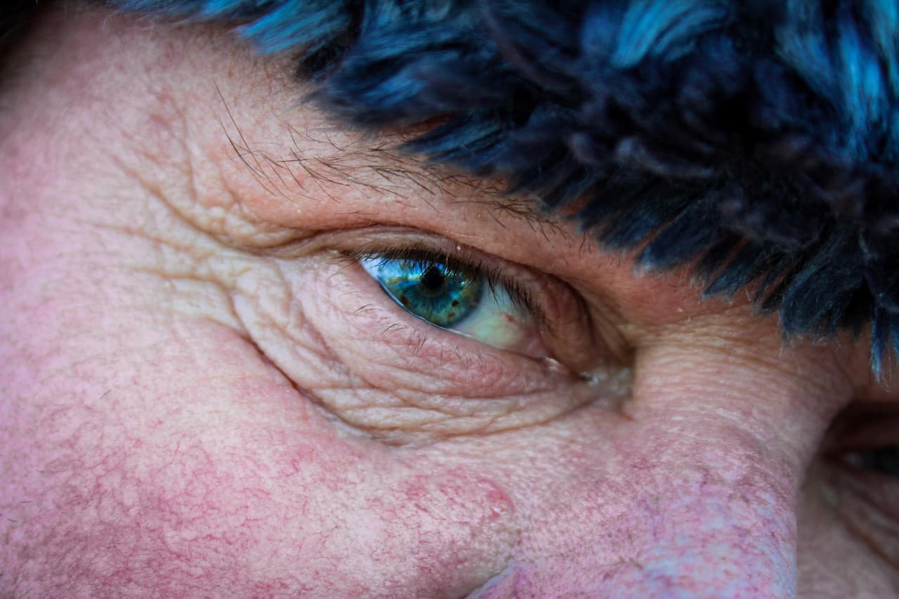 노안과 백내장의 차이, 중장년층이 꼭 알아야 할 눈 건강 구분법