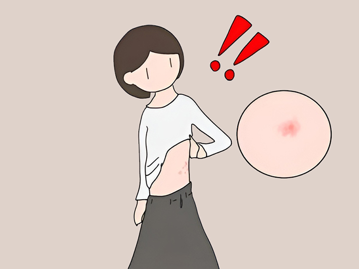 피부에-발진과-수포가-생긴-여성