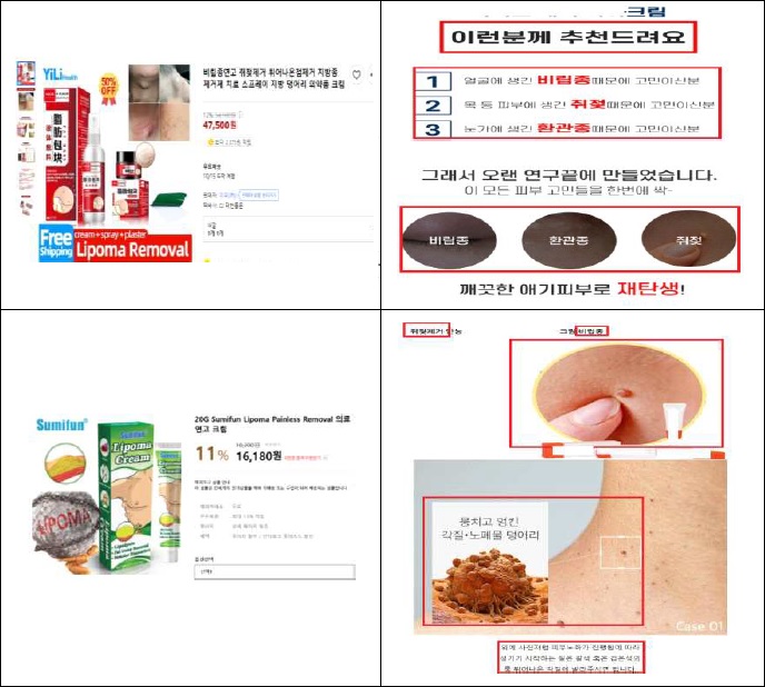 식약처 쥐젖 의약품 불법유통 및 화장품 효능효과 표방 주요 적발사례