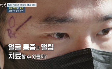 미세혈관감압술환자