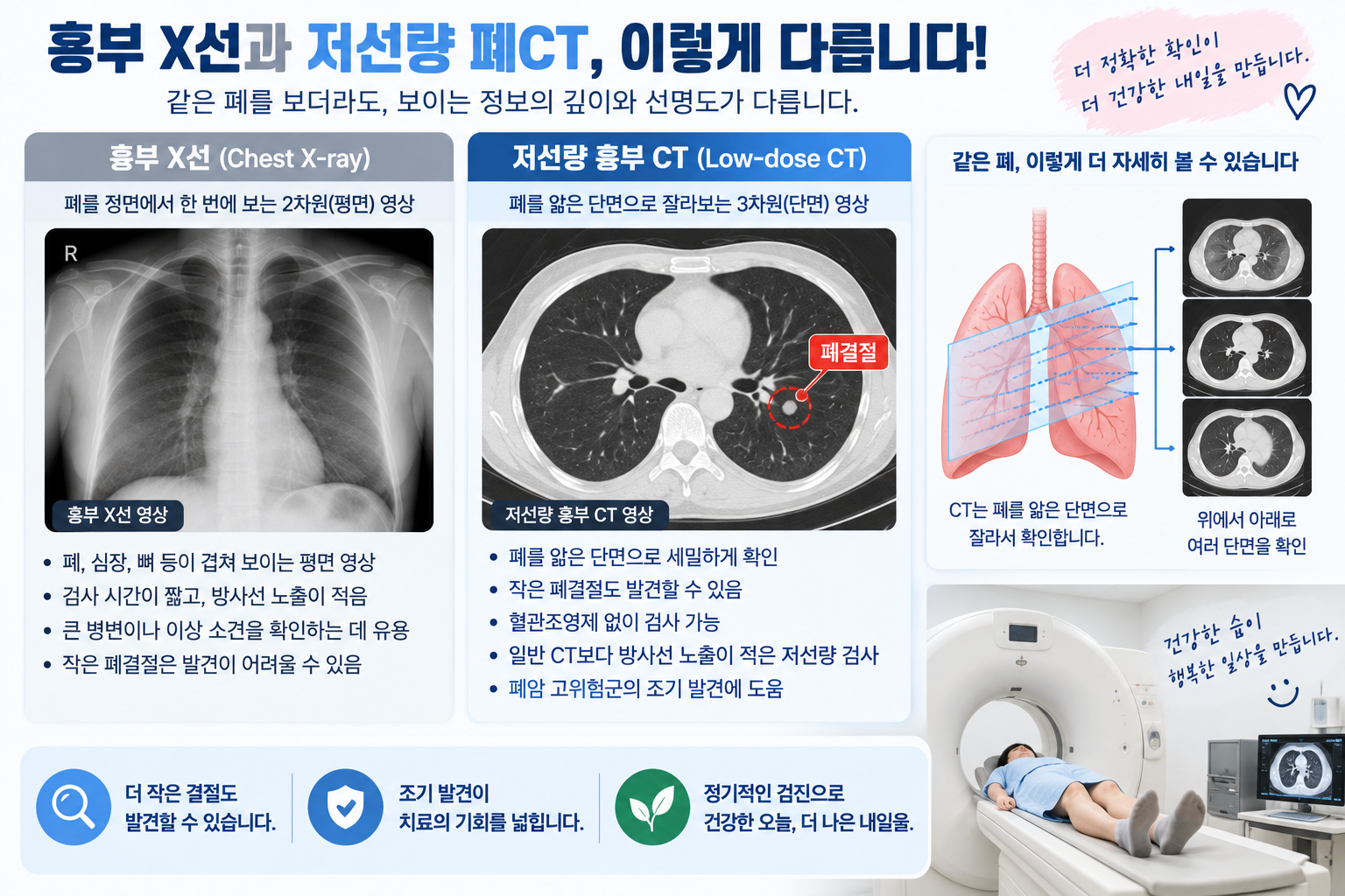 흉부 X선 평면 영상과 저선량 CT 단면 영상을 비교한 설명 그림