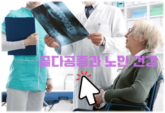 골다공증과 노인 건강: 연관성과 예방 방법 알아보기