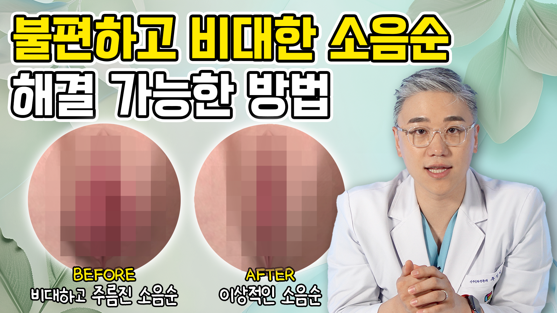 소음순수술 대체 왜 만족도가 높은 걸까? (FEAT.소음순수술잘하는곳)