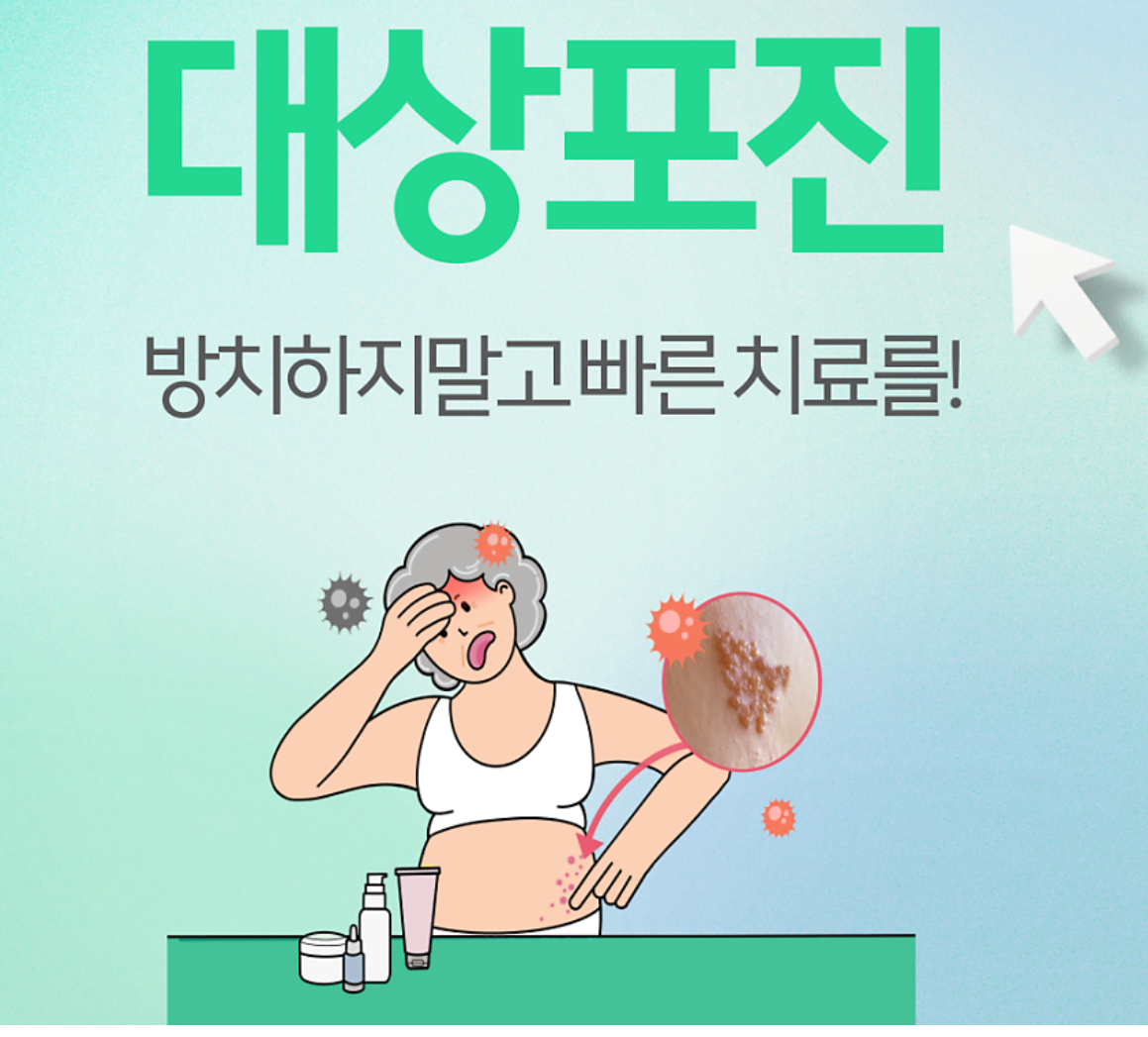 대상포진 치료