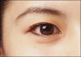 눈에 실핏줄이 터지는 이유-4